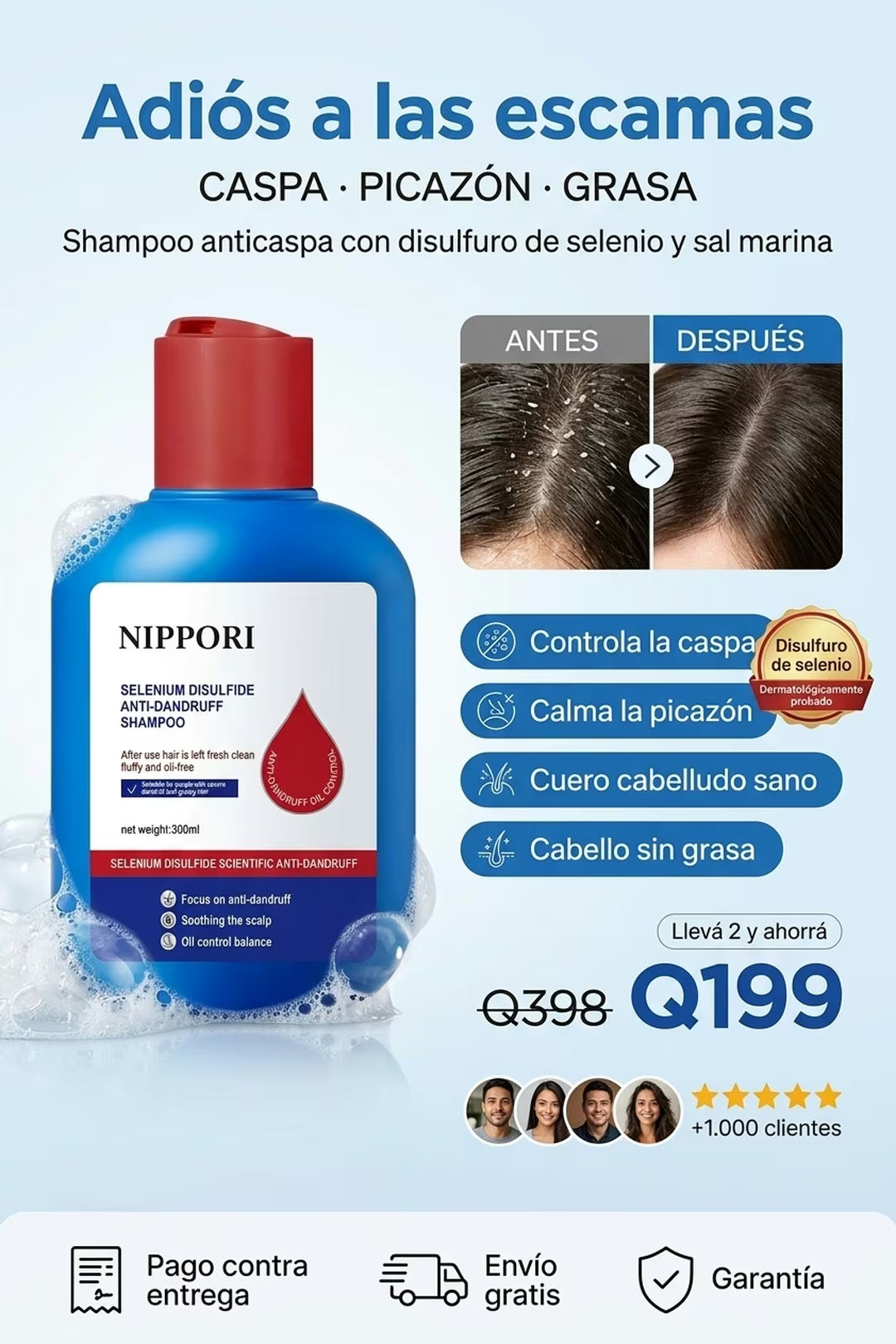 NIPPORI shampoo anticaspa para caspa, picazón y grasa